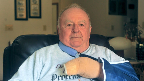 James Vernon, il veterano eroe della biblioteca di Morton, con la mano ferita